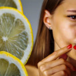 Pimples Inside Lemon