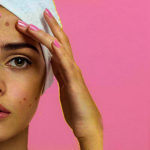 Pimples Website-cover-1400-x-500