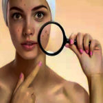 Pimples Website-top-and-mobile-view-275-x-370